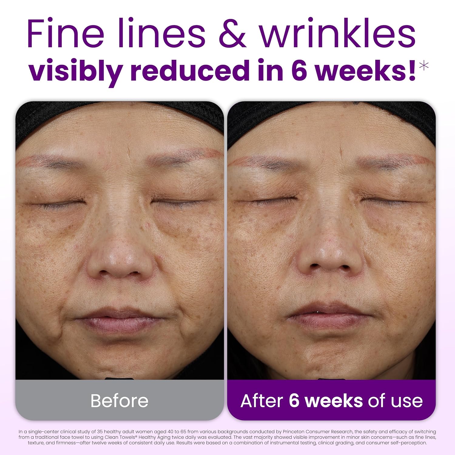 Reduces Fine Lines and Wrinkles in 6 weeks or Less, CLEAN SKIN CLUB Healthy Aging Clean Towels® XL, Disposable Face Towels, XL - 1 Pack (50 count)